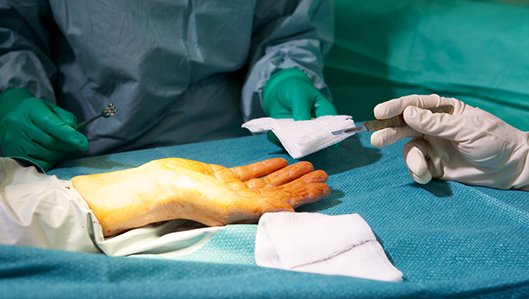 Klinik für Plastische und Ästhetische Chirurgie / Handchirurgie